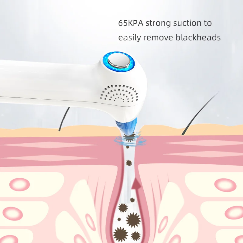 5 Speed Vacuum, 4 Replacement Heads, Hot Cold Light Care LED Screen — image 3
