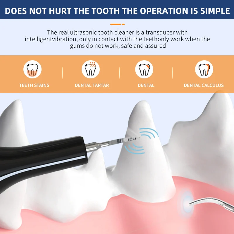 Pet Ultrasonic Dental Scaler Electric Teeth Cleaning Device For Cats And Dogs — image 6