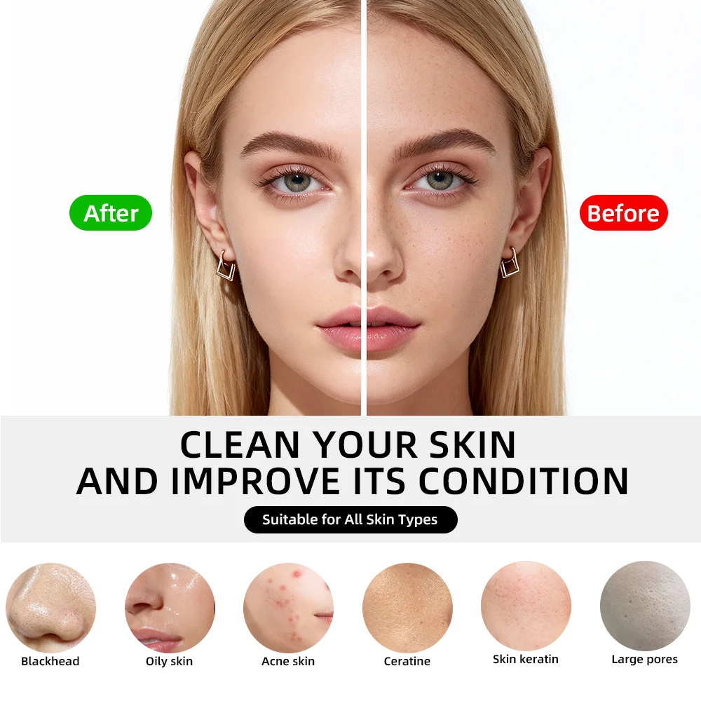 Portable Compact Hot Cold Face Cleaner Heat Clean Converge Pore Management Tool For… — image 7