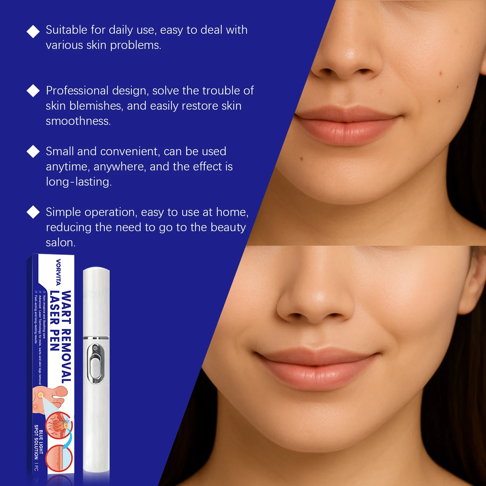 Skin Laser Care Pen 1pc 1 Box — image 8