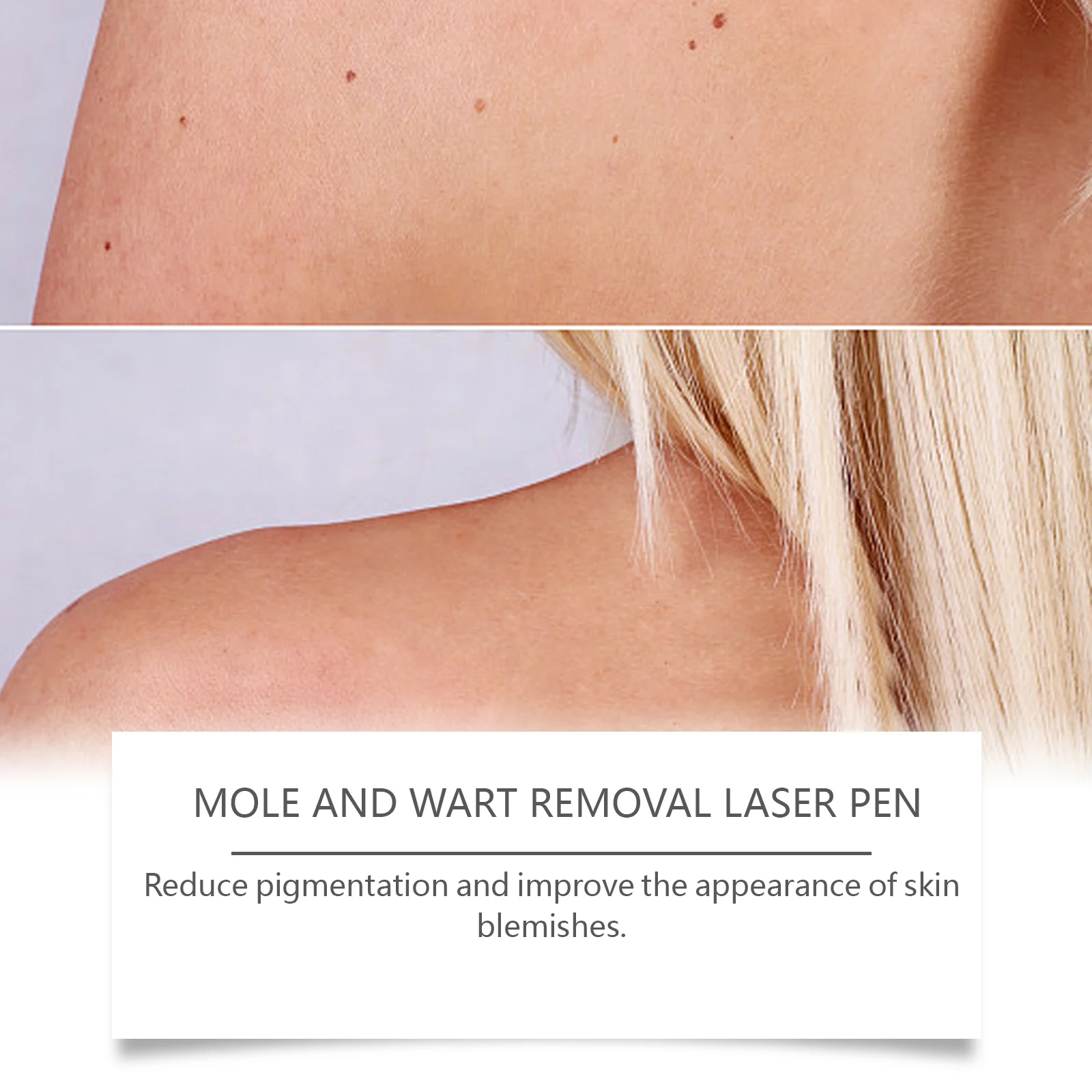 Skin Laser Pen 1pc 1 Box — image 4