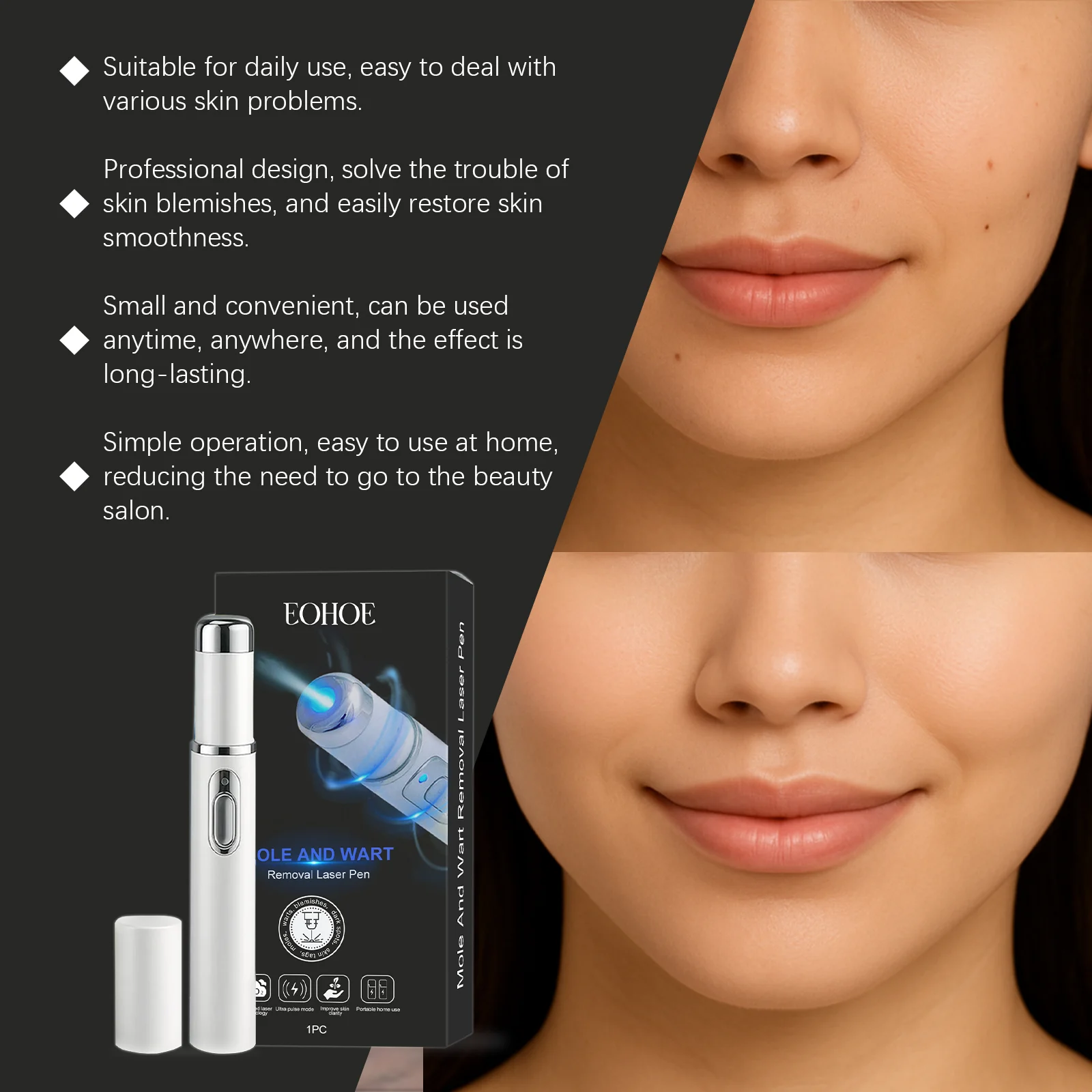 Skin Laser Pen 1pc 1 Box — image 3
